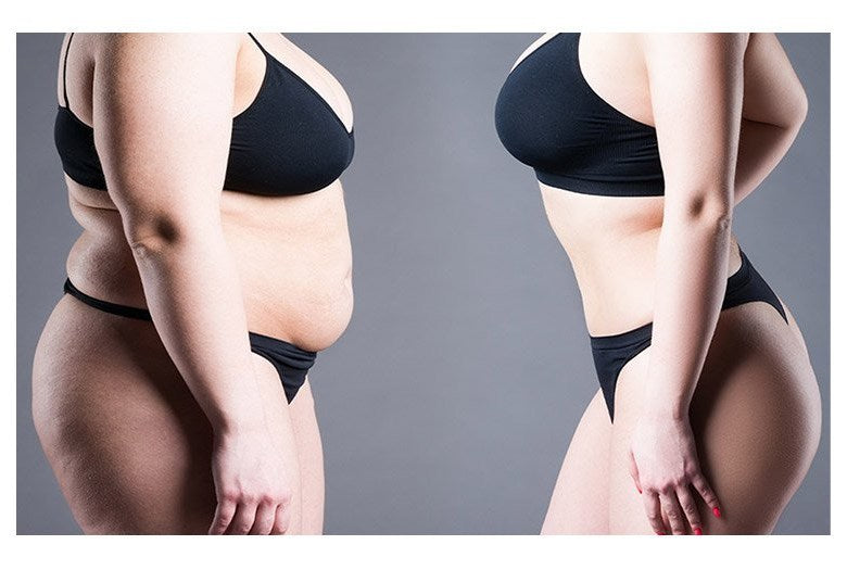 일본교토 쑥 배꼽 패치 슬리밍 패치 식욕억제 잠자는동안 슬리밍 보조 체지방 관리 도움, 5매입, 2개