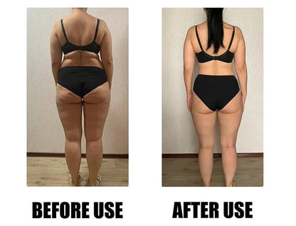 일본교토 쑥 배꼽 패치 슬리밍 패치 식욕억제 잠자는동안 슬리밍 보조 체지방 관리 도움, 5매입, 2개